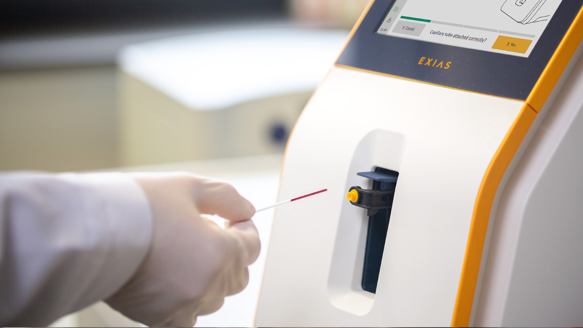 Handskenhånd, der indsætter et blodprøveglas i en medicinsk analysemaskine med en displayskærm.