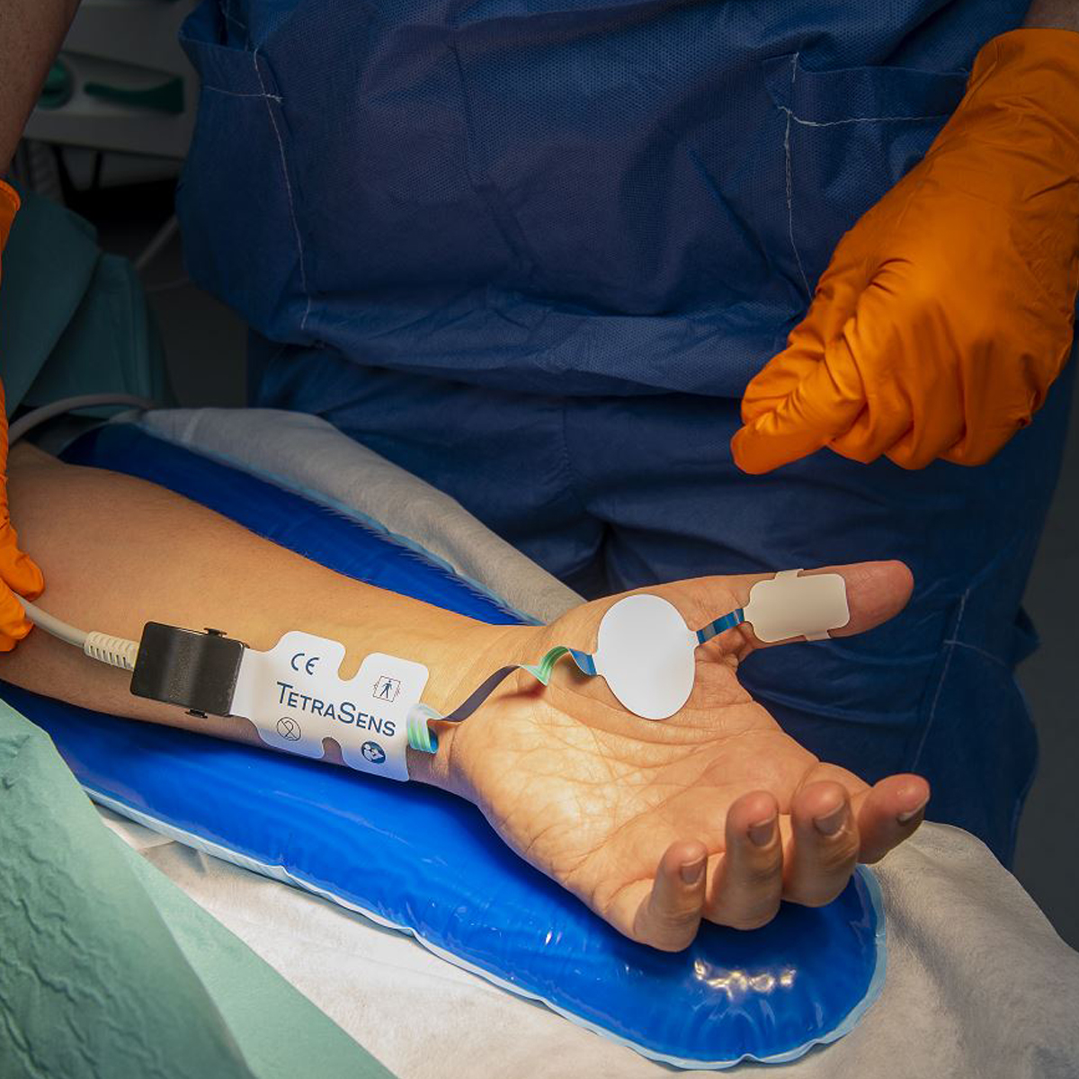 En patients arm med elektroder fästa för övervakning, bredvid en person som bär orangea handskar och blå operationskläder.