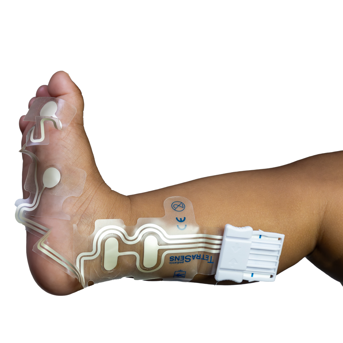 Ett barns fot med en medicinsk sensorplåster och elektroder applicerade på huden, sannolikt för övervakningsändamål.