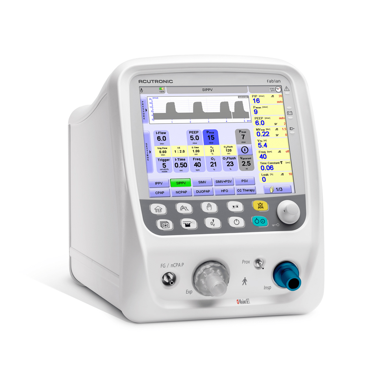 Medicinsk ventilator med digital skærm, der viser indstillinger og grafer for respirationsstøtte.