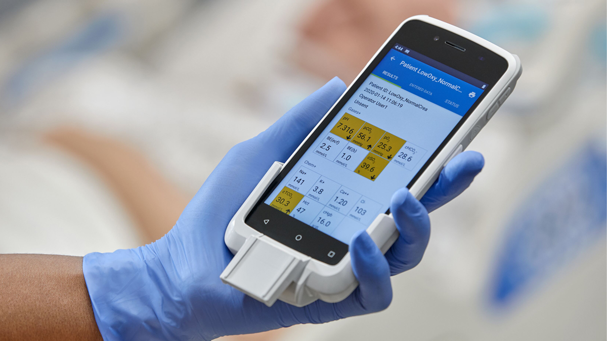 Hånd med blå handske holder en medicinsk måleenhed med patientdata vist på skærmen.