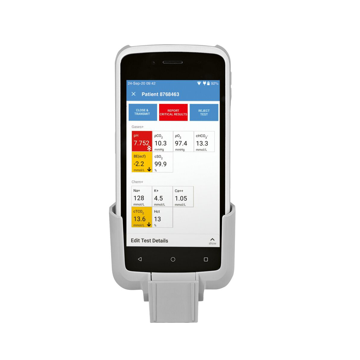 Medicinsk analyseenhed med smartphone, der viser patienttestresultater på skærmen.
